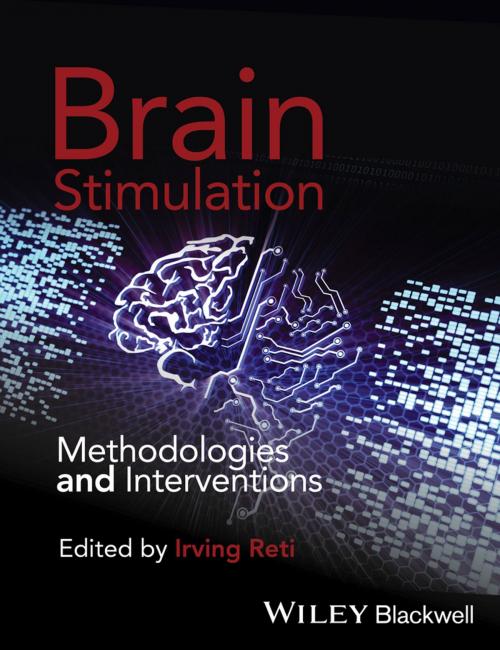 Cover of the book Brain Stimulation by Irving Reti, Wiley