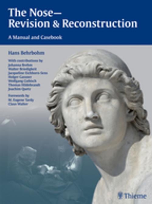 Cover of the book The Nose - Revision and Reconstruction by Hans Behrbohm, Jacqueline Eichhorn-Sens, Joachim Ulrich Quetz, Thieme