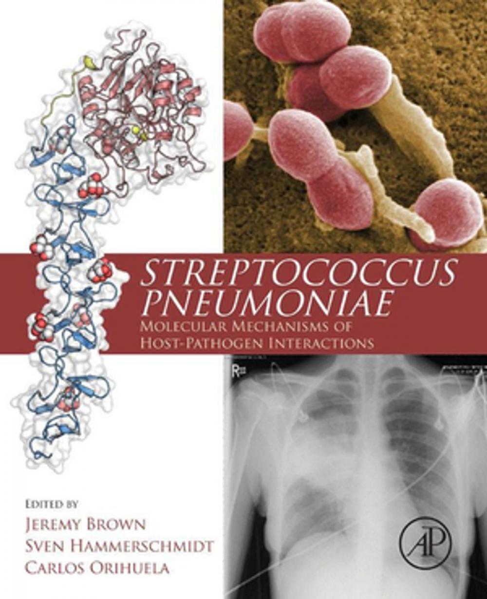 Big bigCover of Streptococcus Pneumoniae