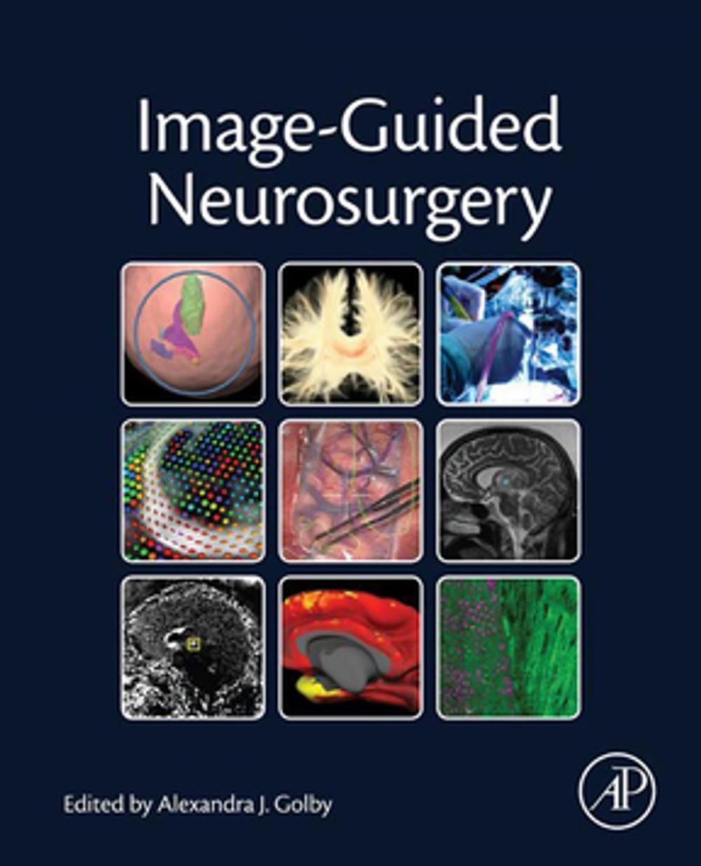 Big bigCover of Image-Guided Neurosurgery