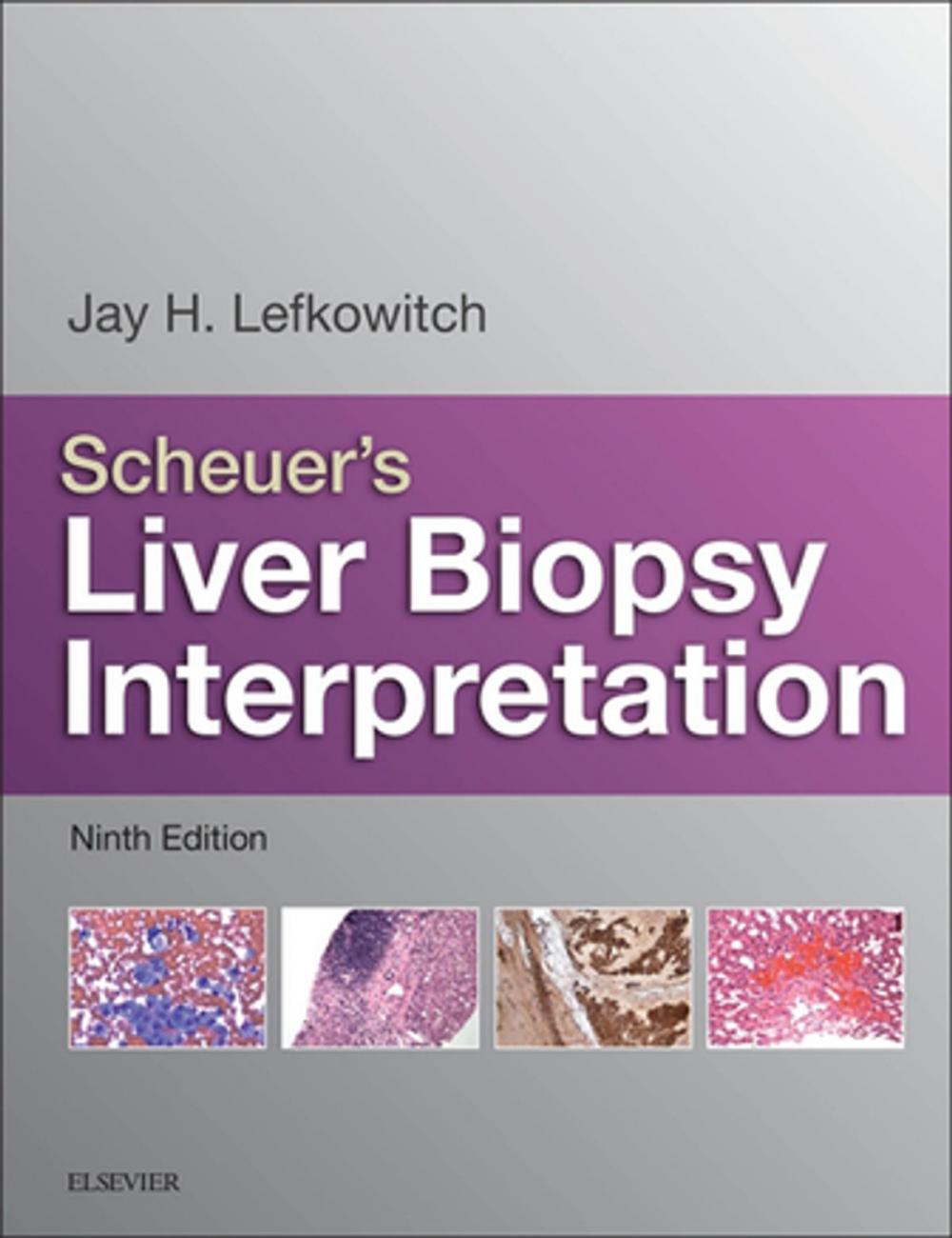 Big bigCover of Scheuer's Liver Biopsy Interpretation E-Book