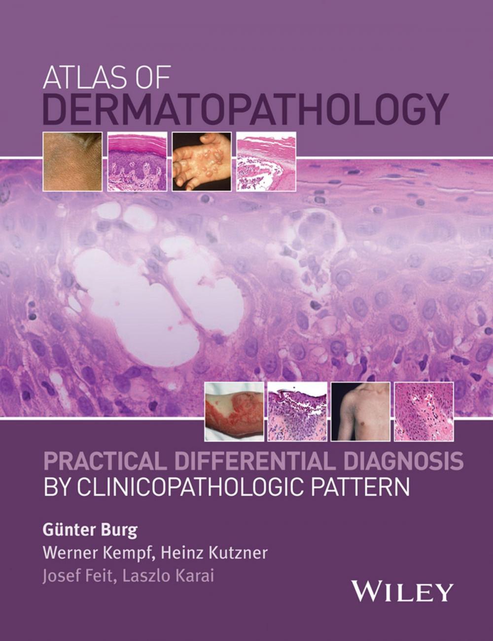 Big bigCover of Atlas of Dermatopathology