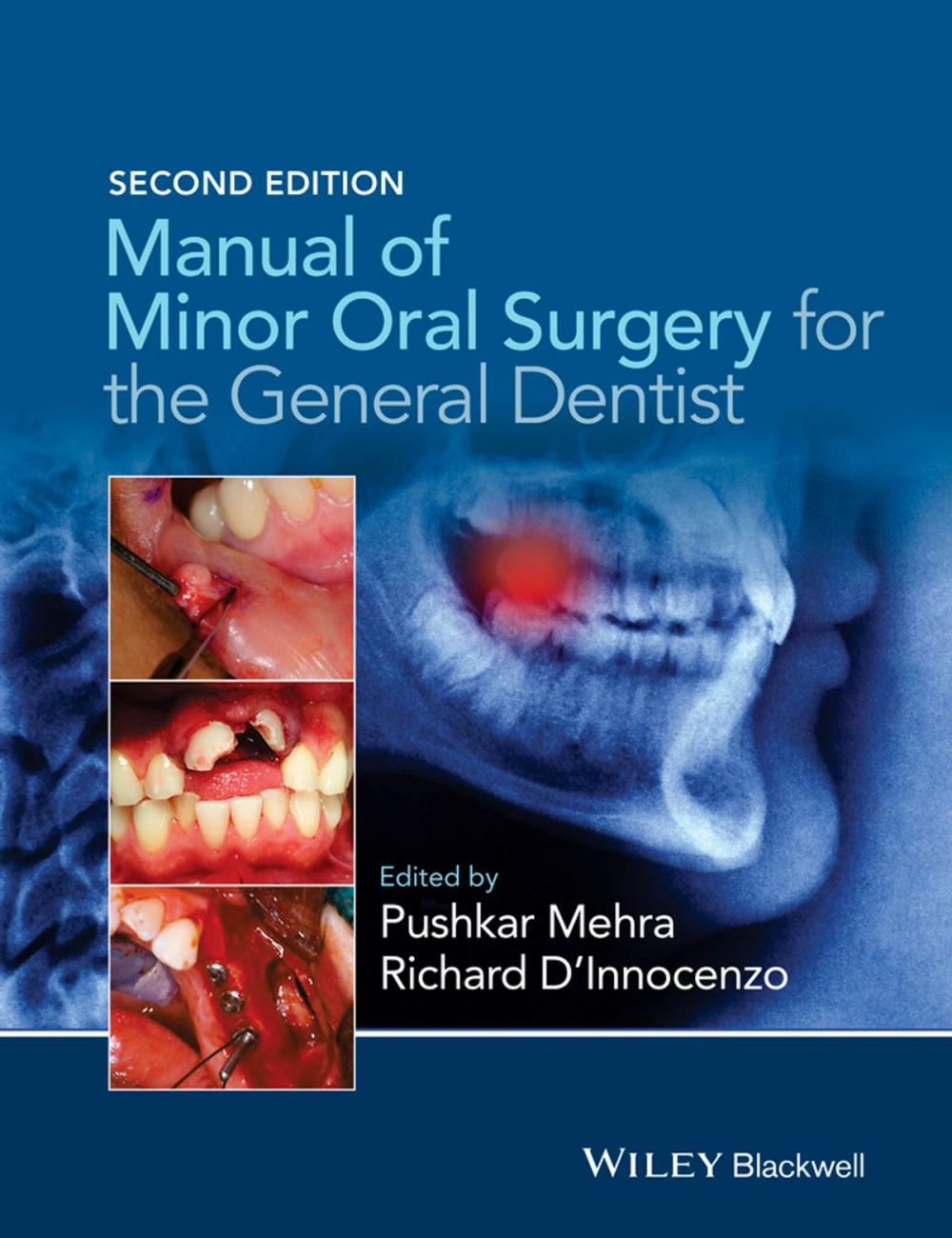 Big bigCover of Manual of Minor Oral Surgery for the General Dentist