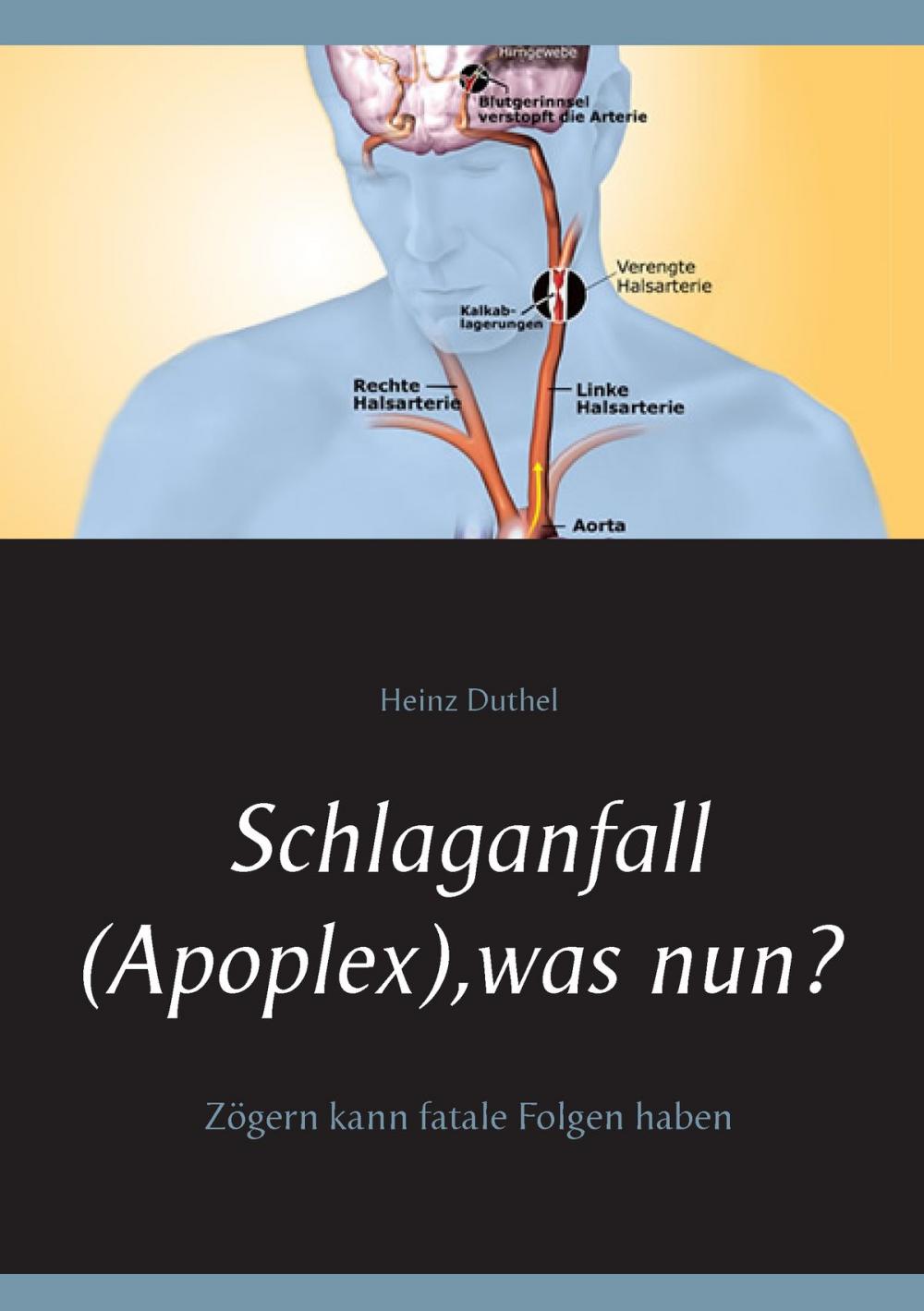 Big bigCover of Schlaganfall (Apoplex), was nun?