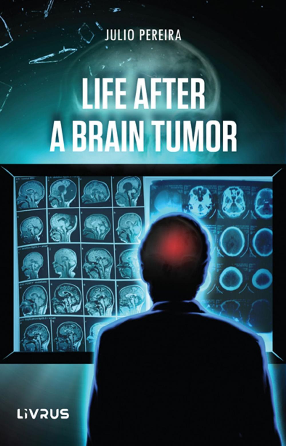 Big bigCover of Life After a Brain Tumor