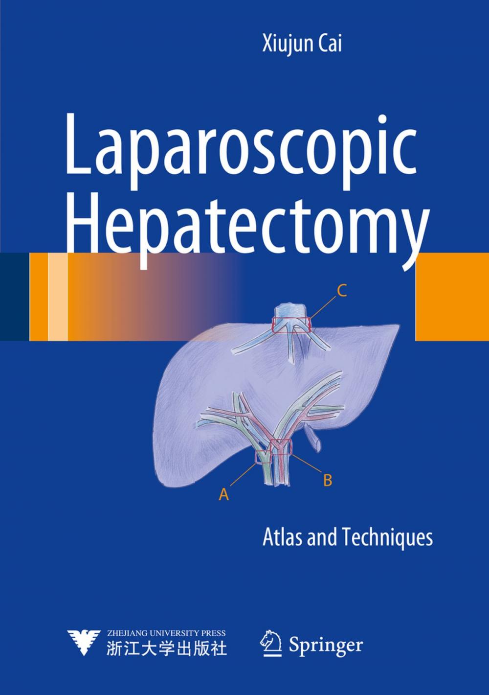 Big bigCover of Laparoscopic Hepatectomy