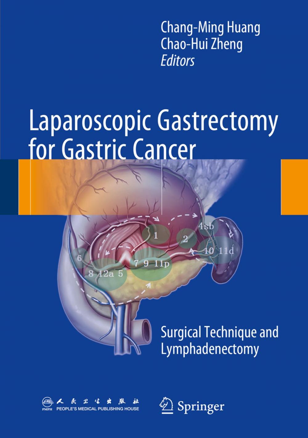 Big bigCover of Laparoscopic Gastrectomy for Gastric Cancer