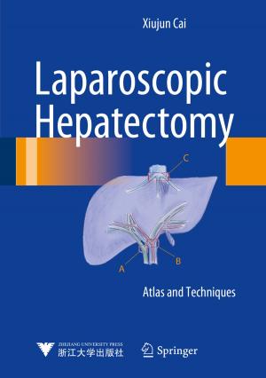 Cover of Laparoscopic Hepatectomy