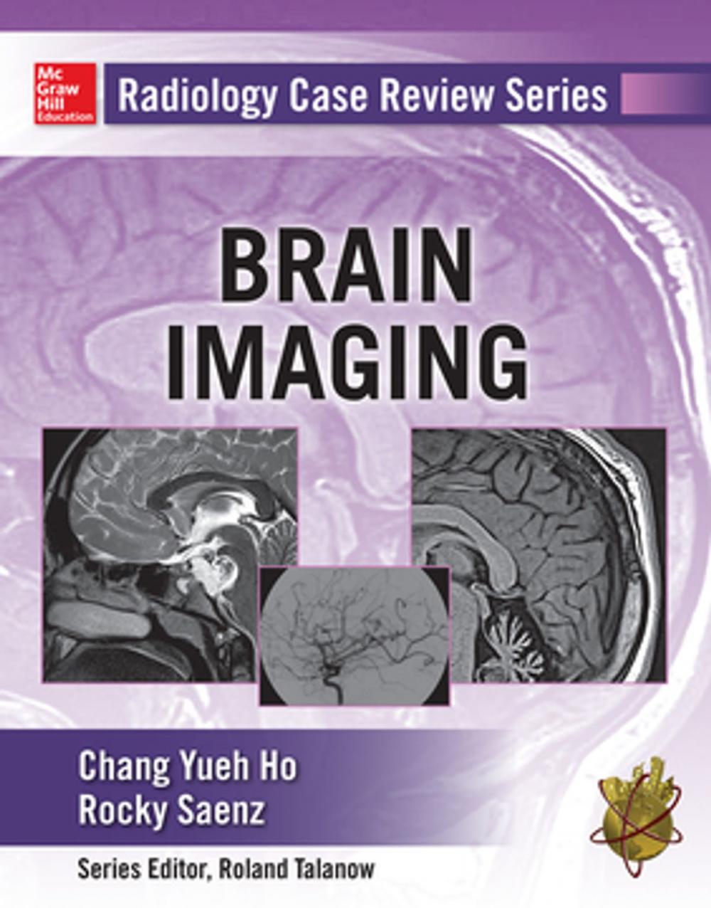 Big bigCover of Radiology Case Review Series: Brain Imaging