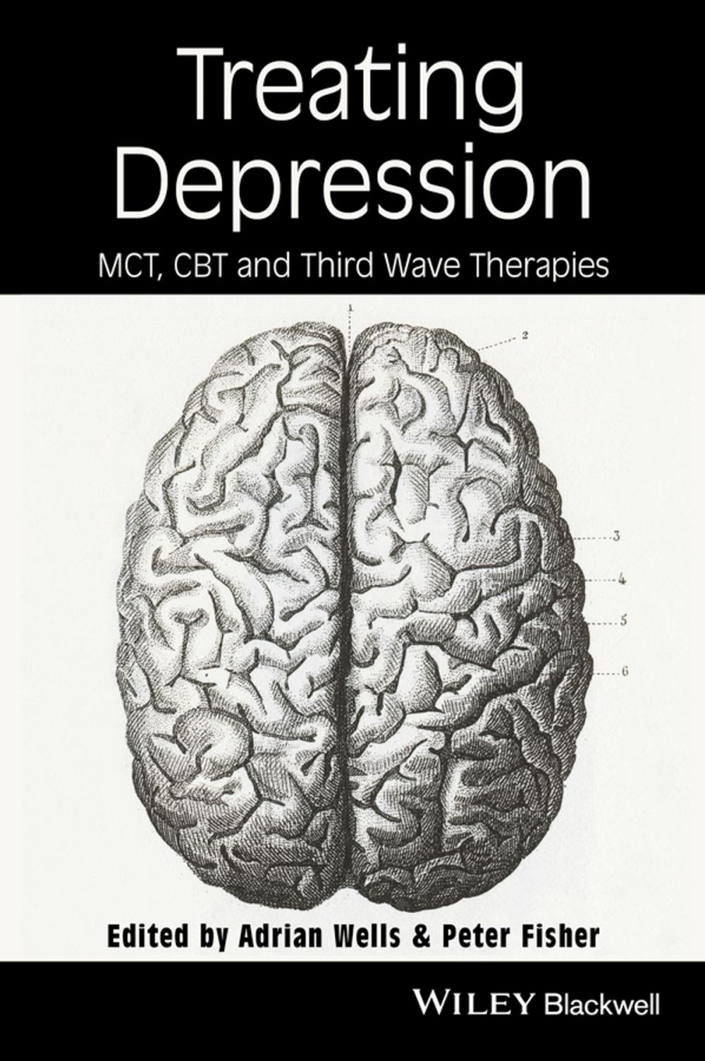 Big bigCover of Treating Depression