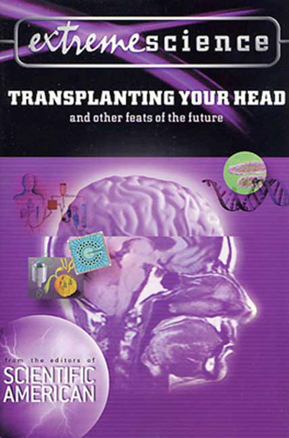 Big bigCover of Extreme Science: Transplanting Your Head