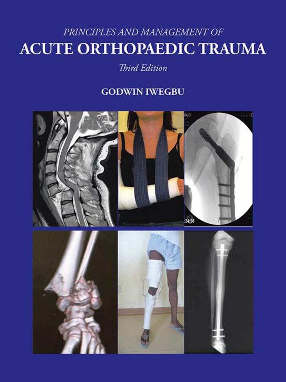 Big bigCover of Principles and Management of Acute Orthopaedic Trauma