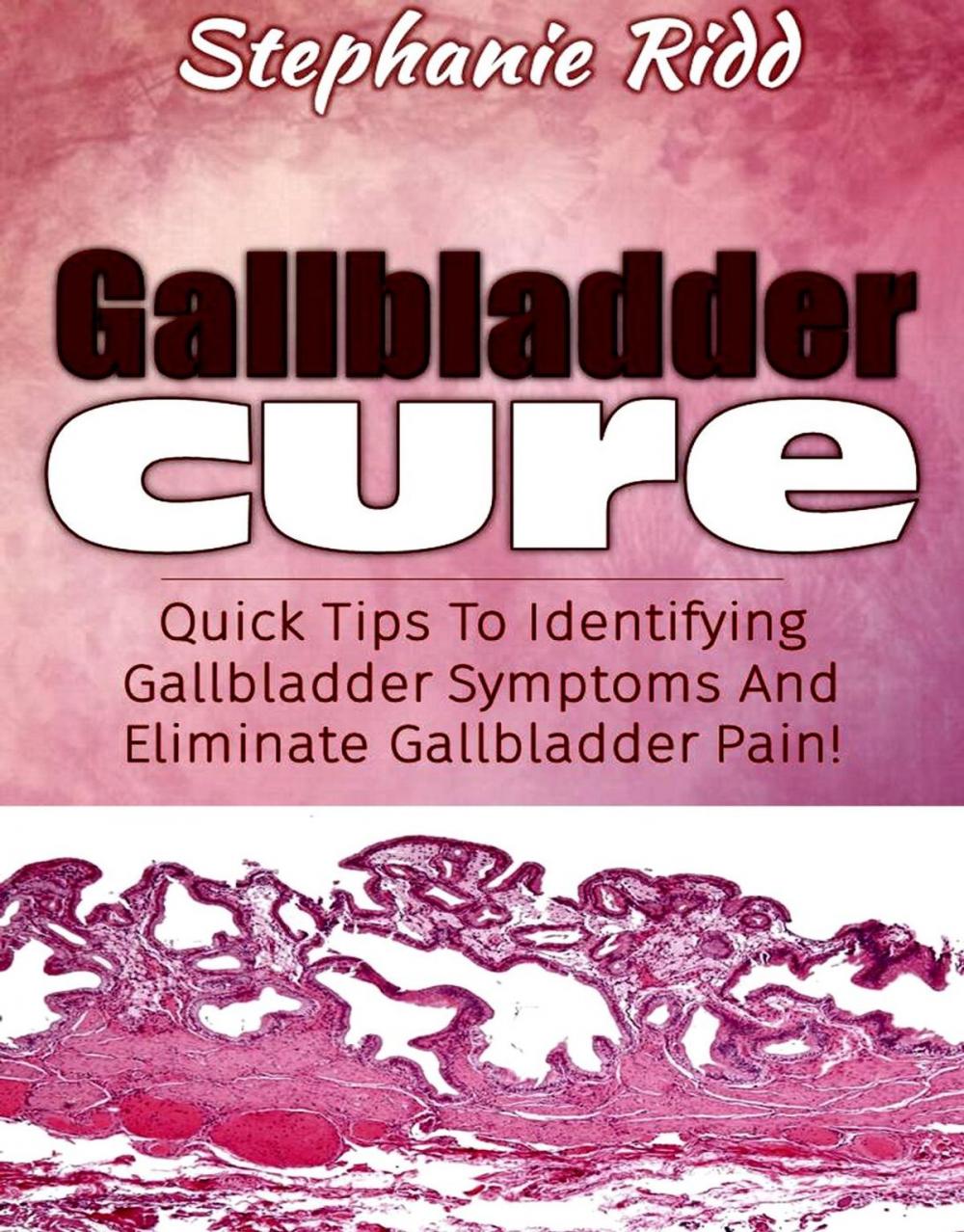 Big bigCover of Gallbladder Cure: Quick Tips To Identifying Gallbladder Symptoms And Eliminate Gallbladder Pain!