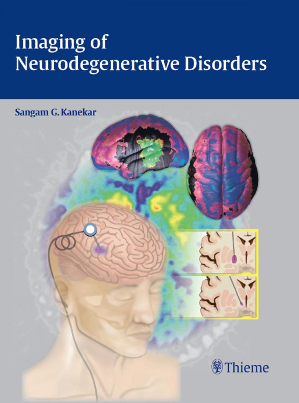 Big bigCover of Imaging of Neurodegenerative Disorders