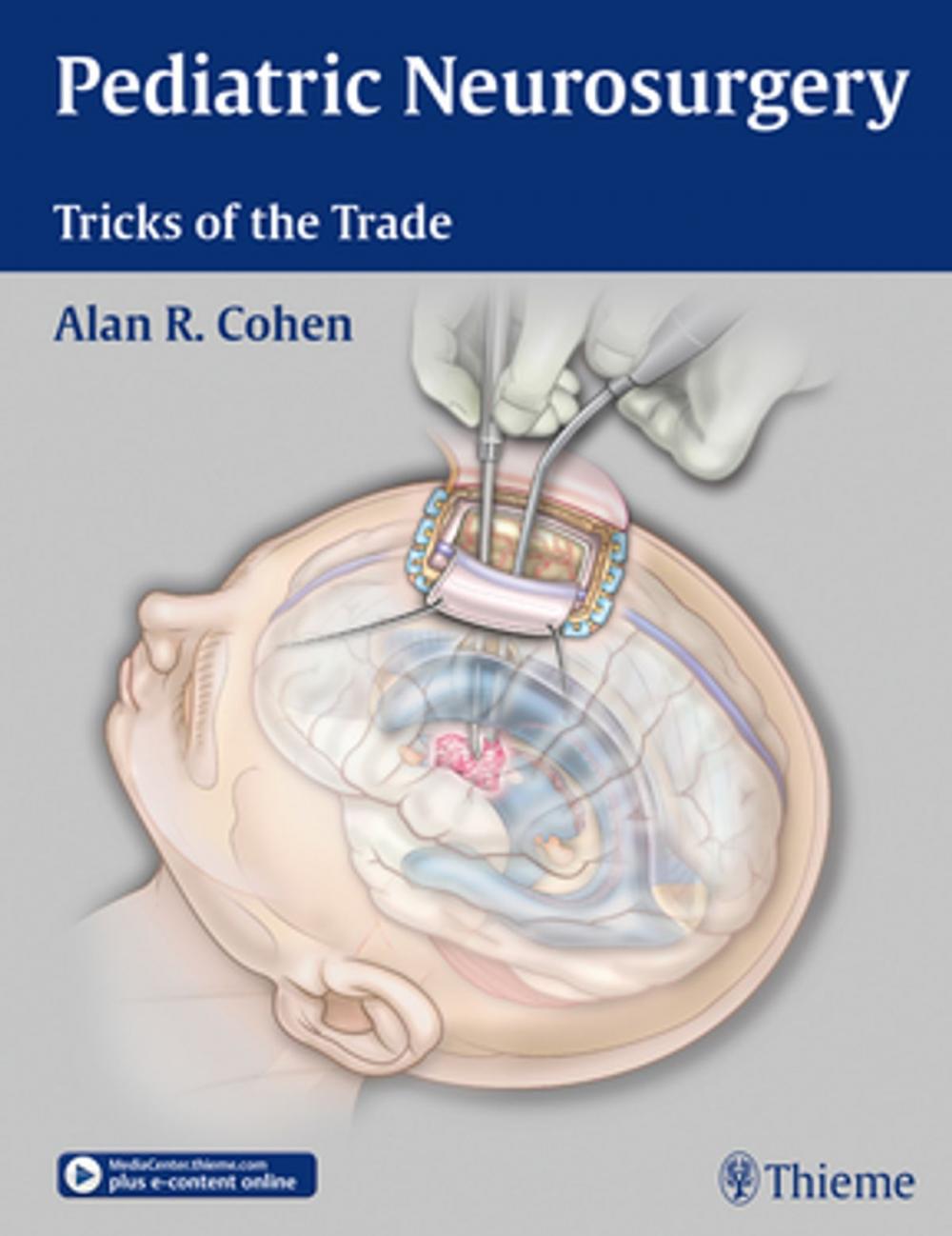 Big bigCover of Pediatric Neurosurgery: Tricks of the Trade