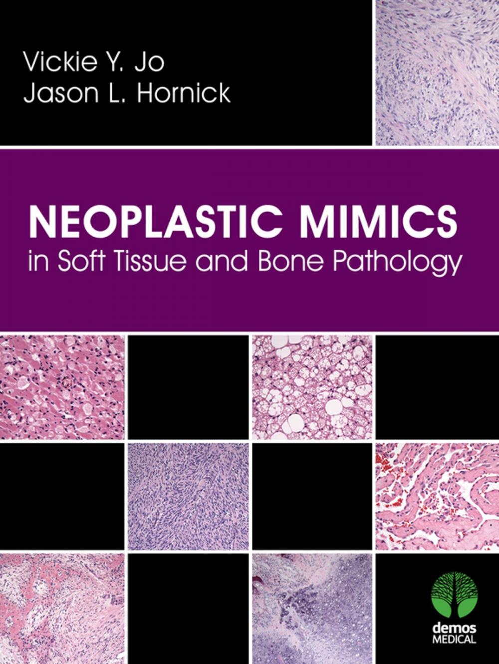 Big bigCover of Neoplastic Mimics in Soft Tissue and Bone Pathology