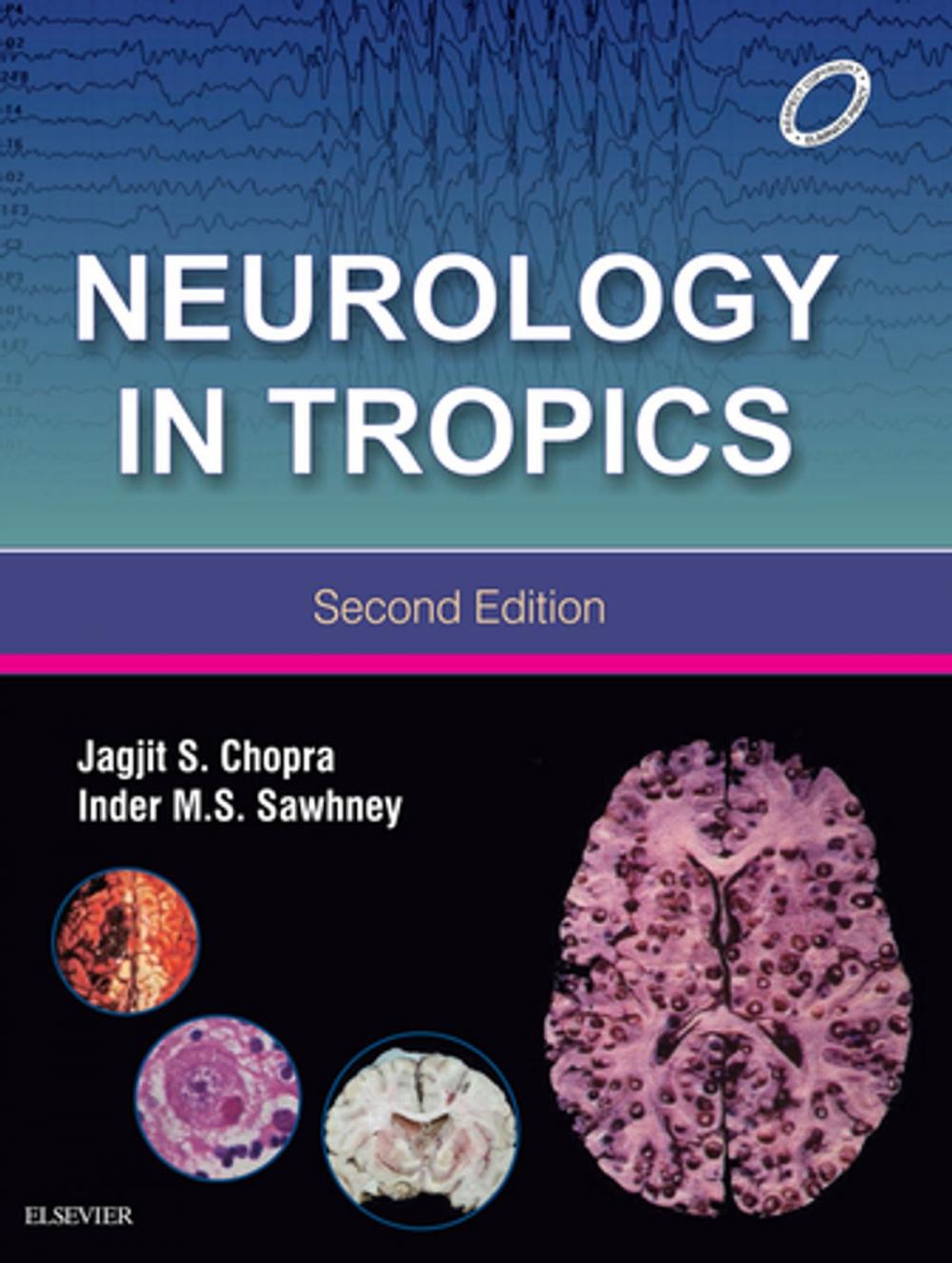 Big bigCover of Neurology in Tropics (E-book)