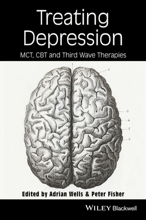 Cover of the book Treating Depression by , Wiley