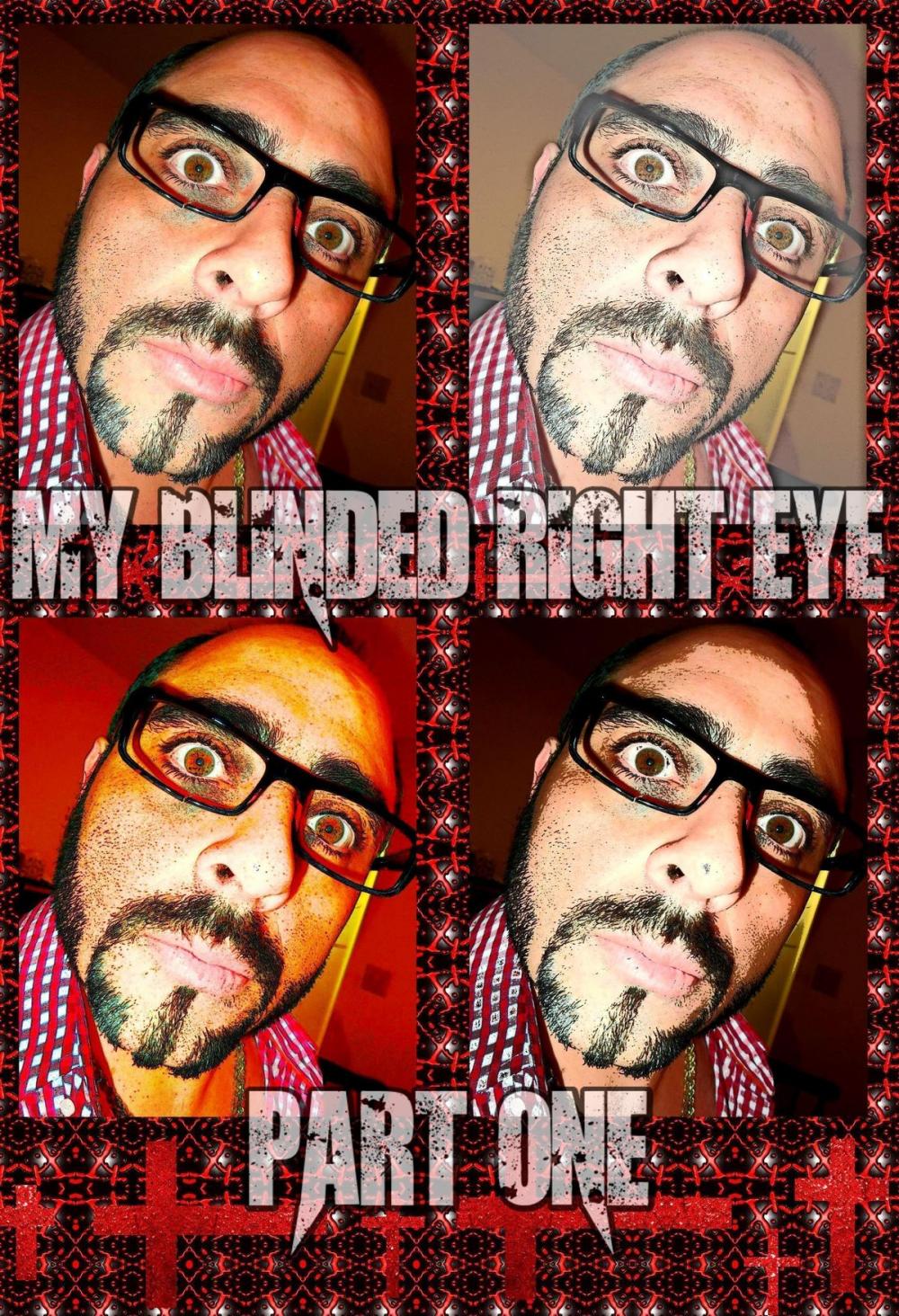 Big bigCover of My Blinded Right Eye. Part 1.