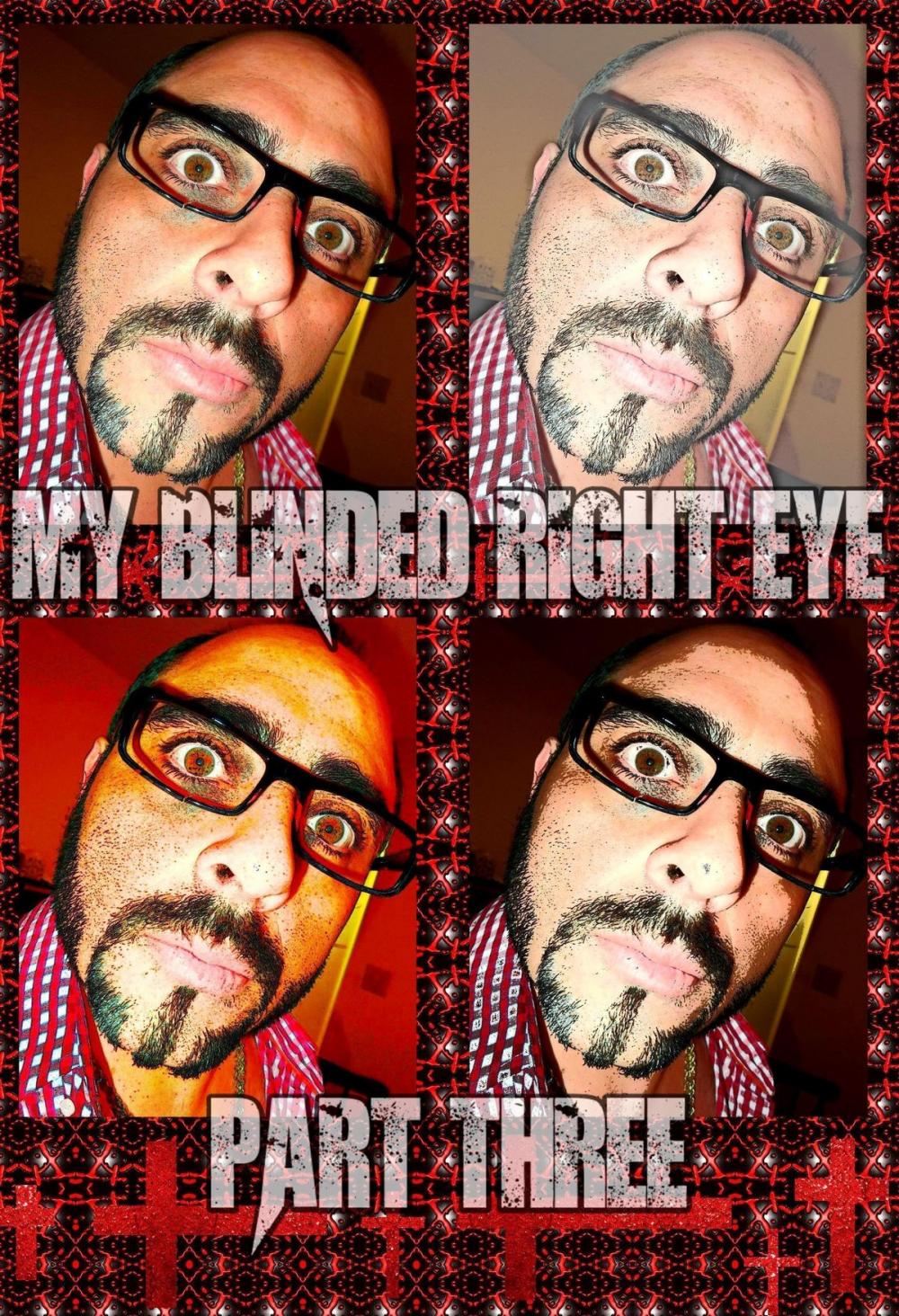 Big bigCover of My Blinded Right Eye. Part 3.