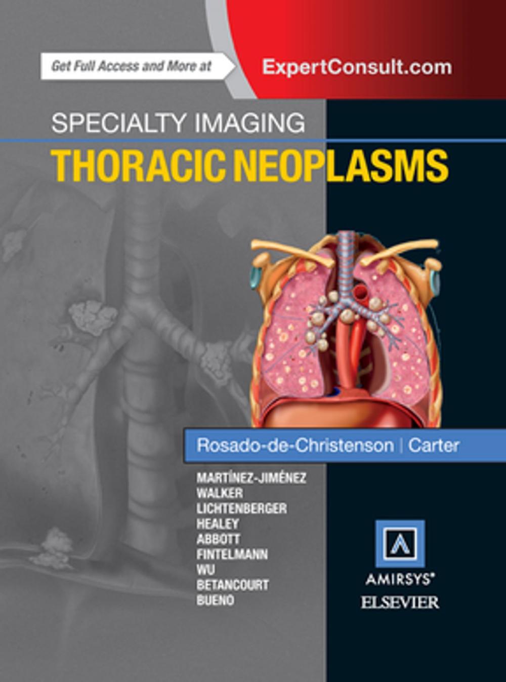 Big bigCover of Specialty Imaging: Thoracic Neoplasms E-Book