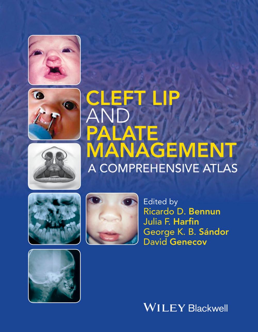 Big bigCover of Cleft Lip and Palate Management