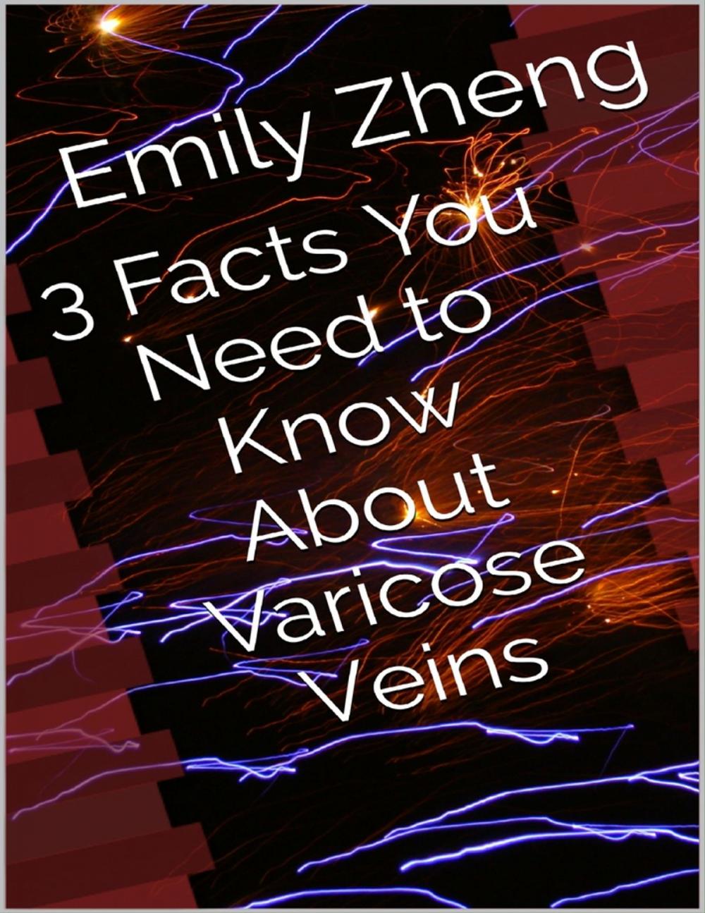 Big bigCover of 3 Facts You Need to Know About Varicose Veins