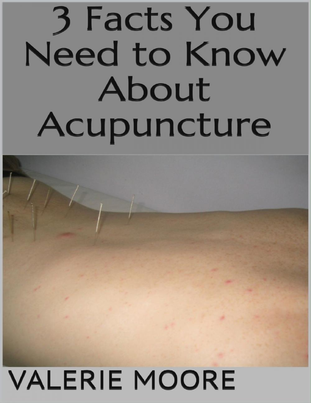 Big bigCover of 3 Facts You Need to Know About Acupuncture