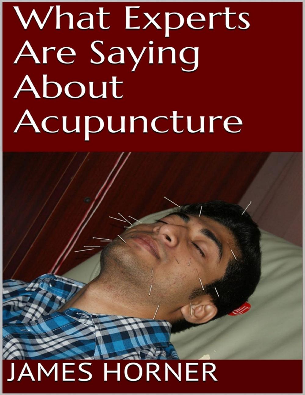 Big bigCover of What Experts Are Saying About Acupuncture