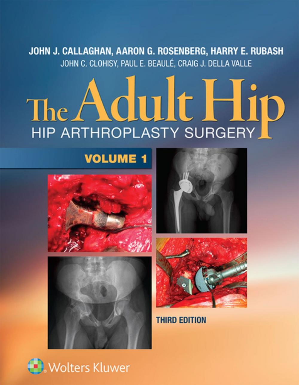 Big bigCover of The Adult Hip