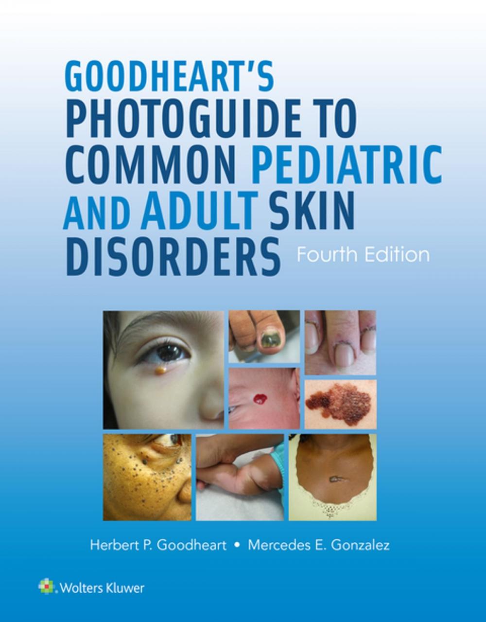 Big bigCover of Goodheart's Photoguide to Common Pediatric and Adult Skin Disorders