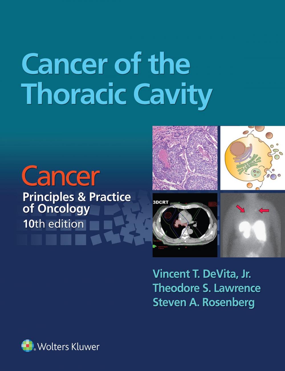 Big bigCover of Cancer of the Thoracic Cavity