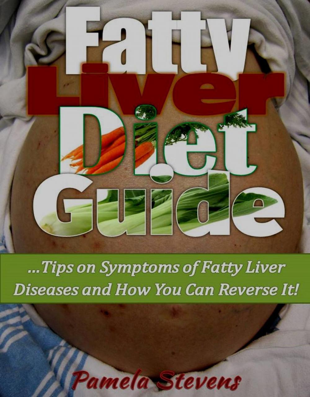 Big bigCover of Fatty Liver Diet Guide: Tips on Symptoms of Fatty Liver Disease and How You Can Reverse It!