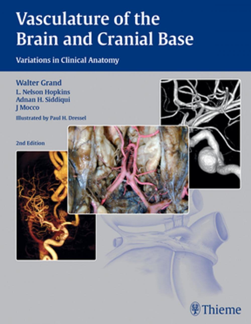 Big bigCover of Vasculature of the Brain and Cranial Base