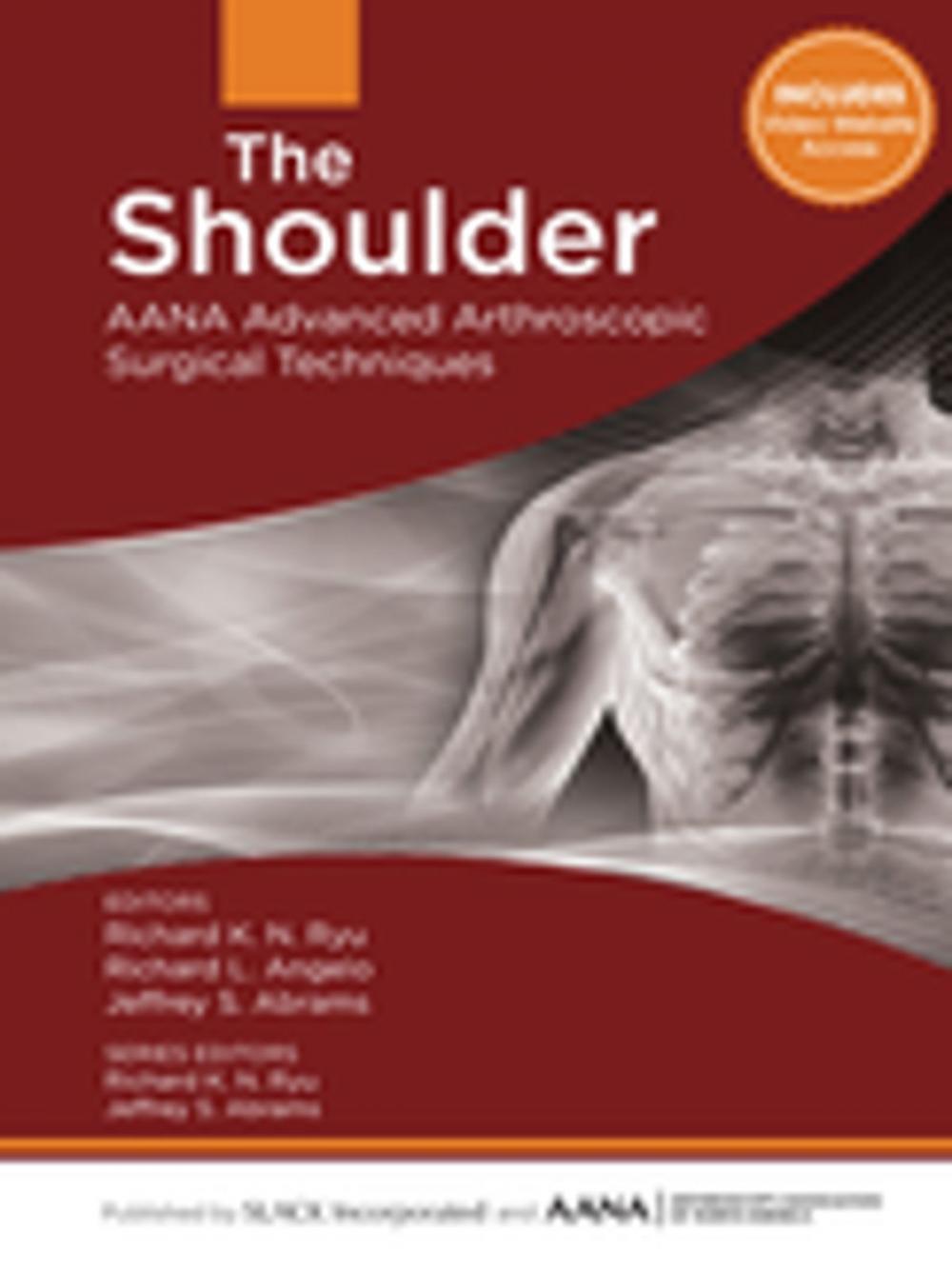 Big bigCover of The Shoulder