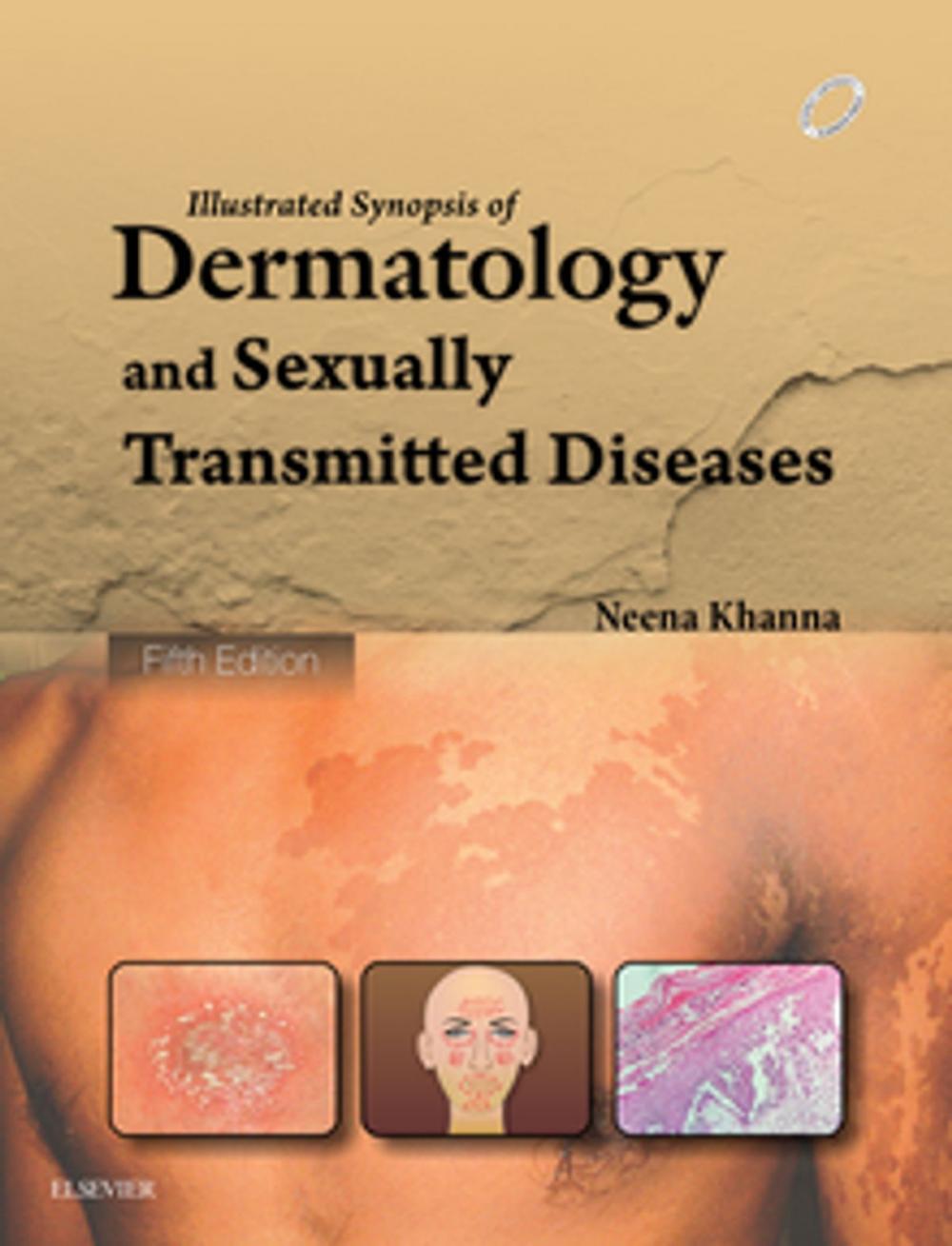 Big bigCover of Illustrated Synopsis of Dermatology & Sexually Transmitted Diseases - E-book