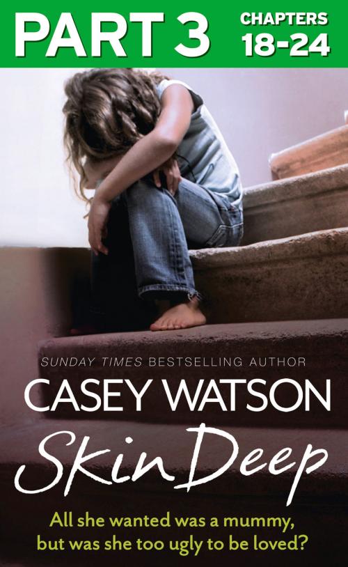 Cover of the book Skin Deep: Part 3 of 3: All she wanted was a mummy, but was she too ugly to be loved? by Casey Watson, HarperCollins Publishers