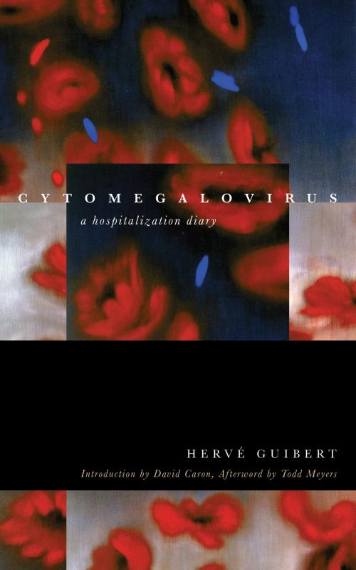 Cover of the book Cytomegalovirus by Hervé Guibert, Todd Meyers, Fordham University Press