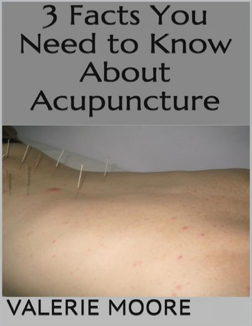 Cover of the book 3 Facts You Need to Know About Acupuncture by Valerie Moore, Lulu.com