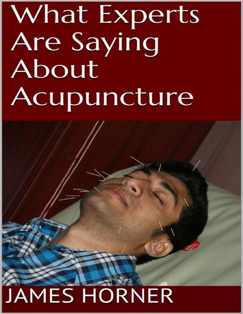 Cover of the book What Experts Are Saying About Acupuncture by James Horner, Lulu.com