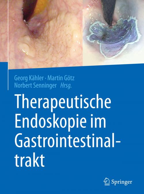 Cover of the book Therapeutische Endoskopie im Gastrointestinaltrakt by , Springer Berlin Heidelberg