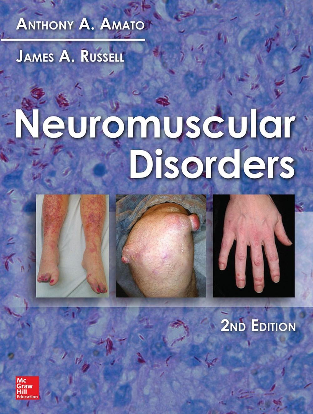 Big bigCover of Neuromuscular Disorders, 2nd Edition