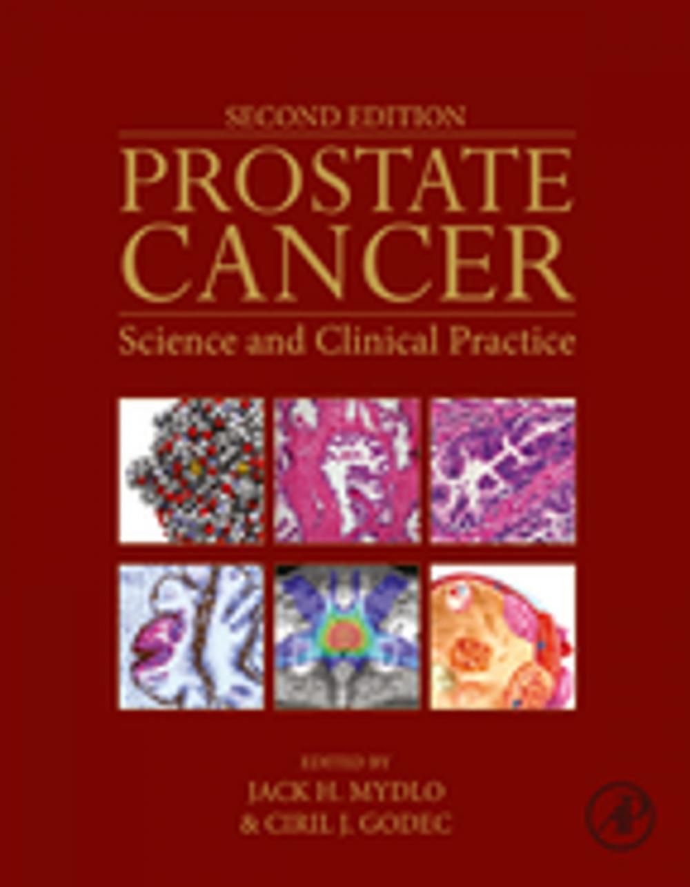 Big bigCover of Prostate Cancer