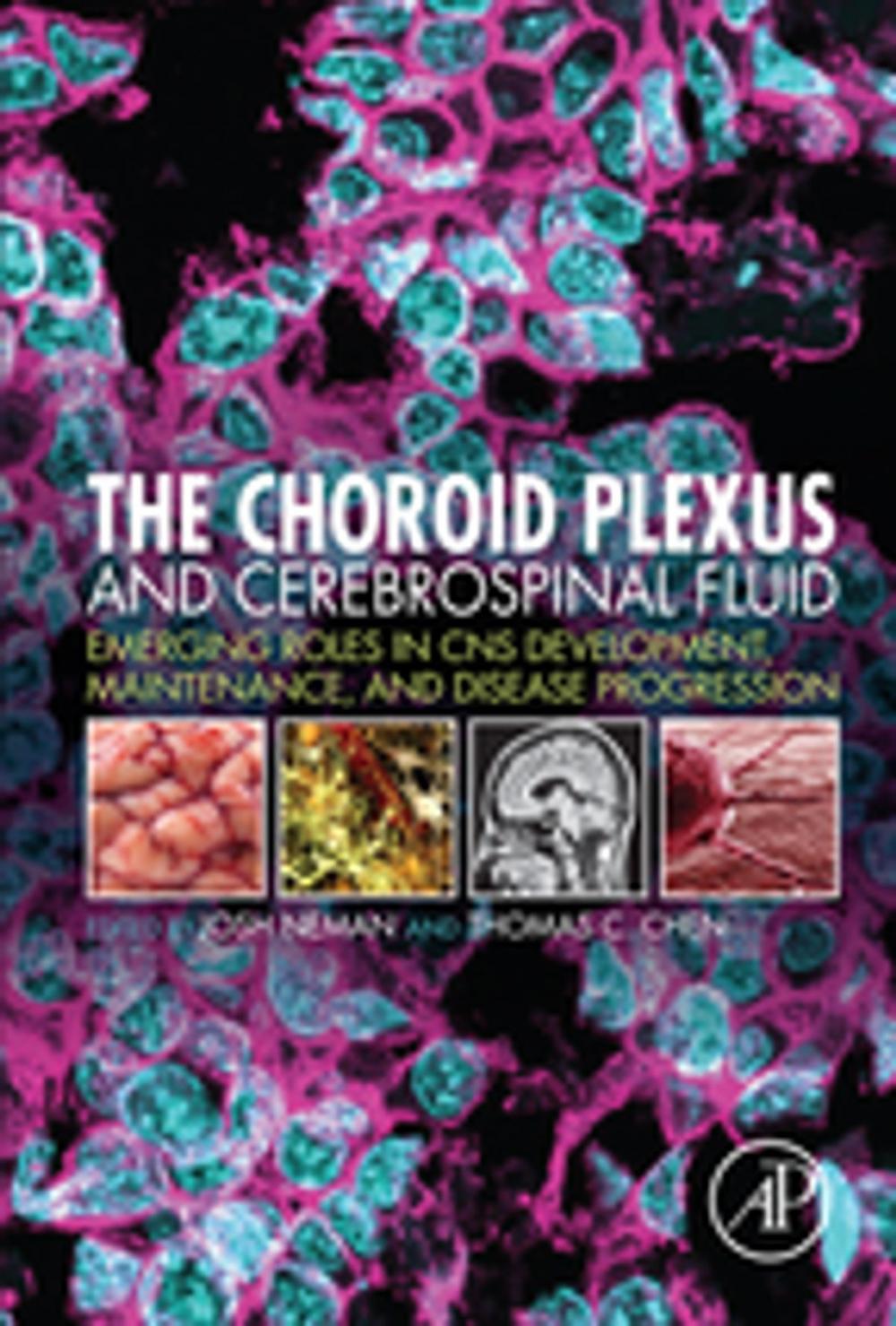 Big bigCover of The Choroid Plexus and Cerebrospinal Fluid