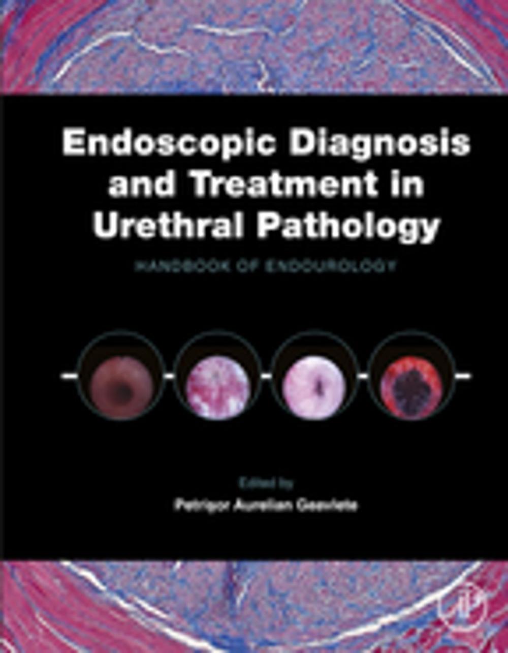 Big bigCover of Endoscopic Diagnosis and Treatment in Urethral Pathology