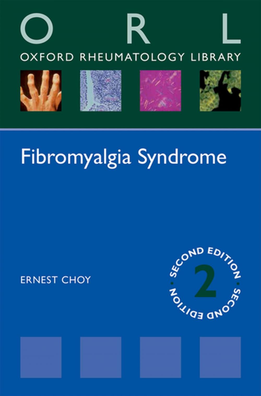 Big bigCover of Fibromyalgia Syndrome