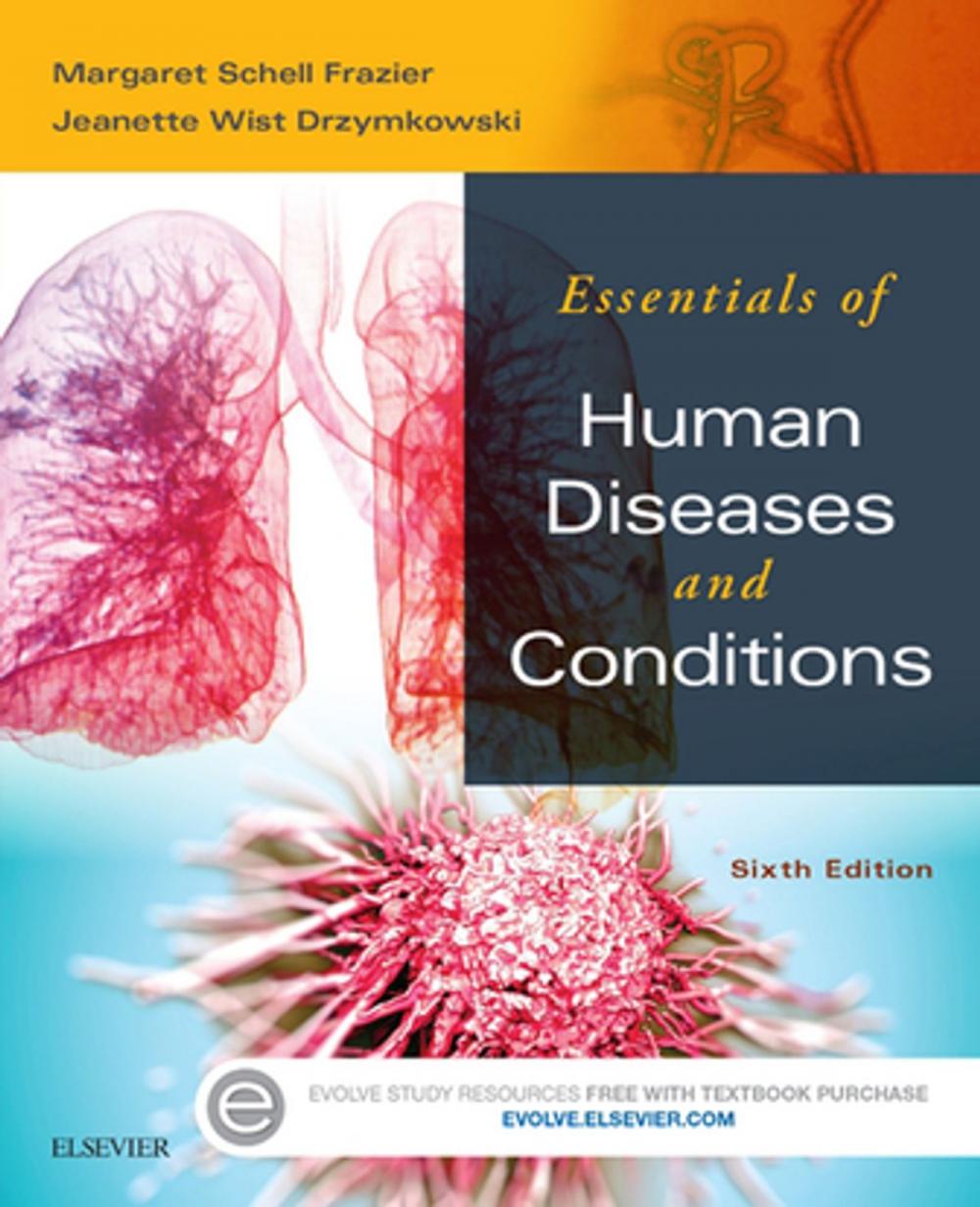 Big bigCover of Essentials of Human Diseases and Conditions - E-Book