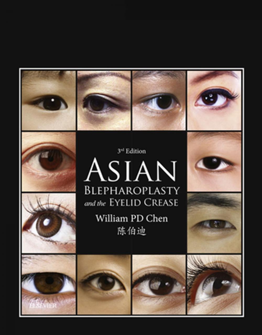 Big bigCover of Asian Blepharoplasty and the Eyelid Crease E-Book