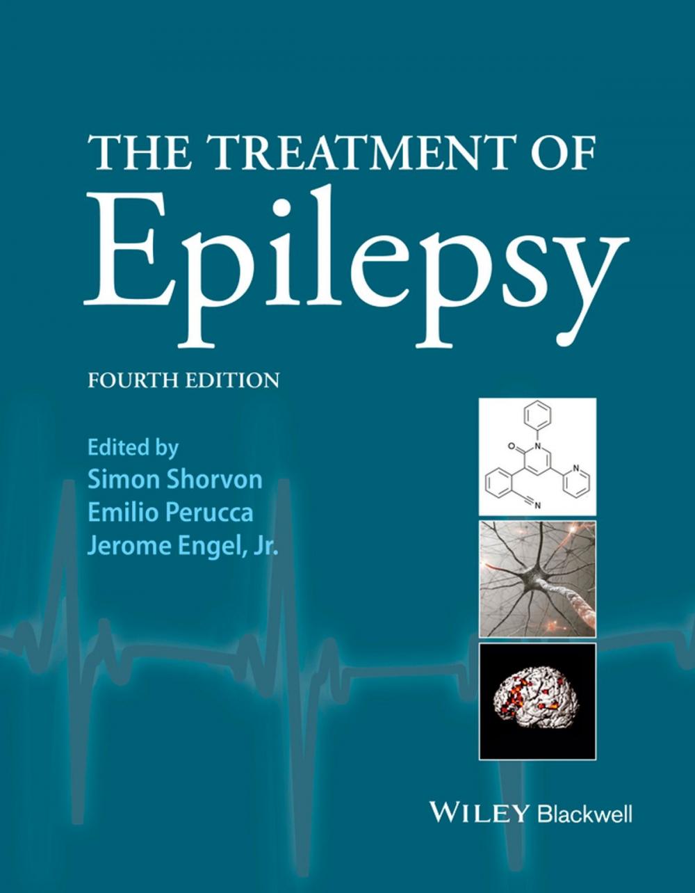 Big bigCover of The Treatment of Epilepsy