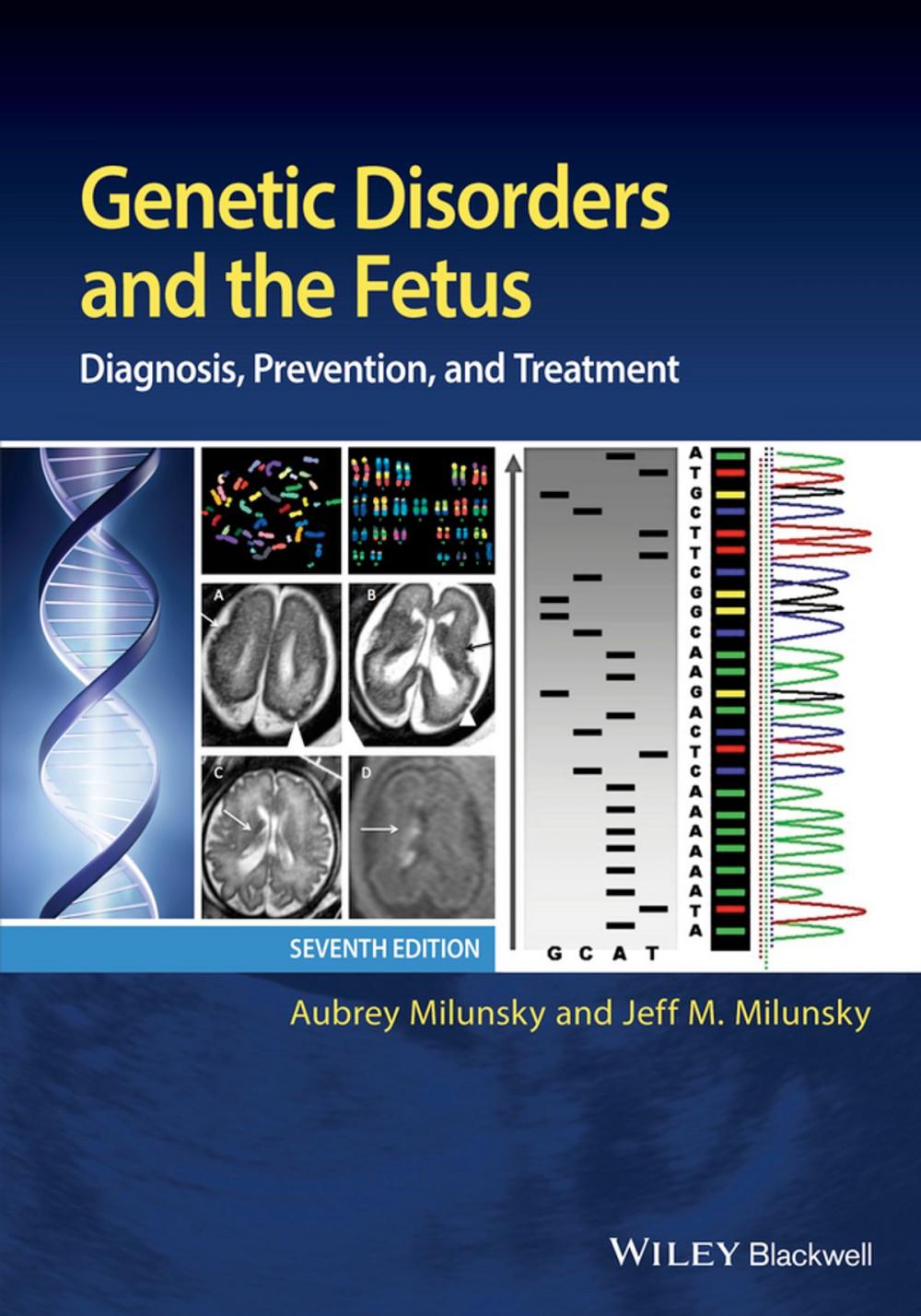 Big bigCover of Genetic Disorders and the Fetus